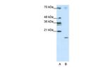 SRP19 Antibody in Western Blot (WB)