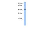 SRSF6 Antibody in Western Blot (WB)