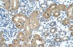 TRNT1 Antibody in Immunohistochemistry (Paraffin) (IHC (P))