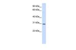 RBM7 Antibody in Western Blot (WB)