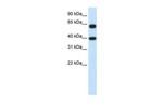 NXF3 Antibody in Western Blot (WB)