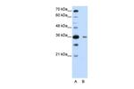 DAZAP1 Antibody in Western Blot (WB)