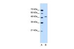 SEMG1 Antibody in Western Blot (WB)