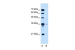 SLC17A3 Antibody in Western Blot (WB)