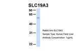 SLC19A3 Antibody in Western Blot (WB)