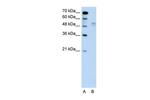 AIP2 Antibody in Western Blot (WB)