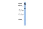 SLC45A2 Antibody in Western Blot (WB)