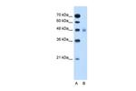 SLC17A4 Antibody in Western Blot (WB)