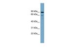 SLC26A9 Antibody in Western Blot (WB)