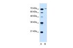 SLCO6A1 Antibody in Western Blot (WB)