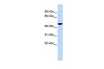 PTGIS Antibody in Western Blot (WB)