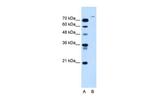 USP48 Antibody in Western Blot (WB)