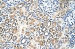 RFC5 Antibody in Immunohistochemistry (IHC)