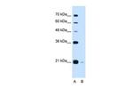 XTP3TPA Antibody in Western Blot (WB)