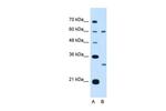 TSPAN32 Antibody in Western Blot (WB)