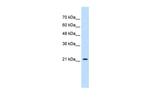 PGRMC1 Antibody in Western Blot (WB)