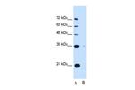 TOR1B Antibody in Western Blot (WB)