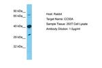 TMEM30A Antibody in Western Blot (WB)
