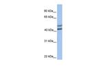 GALT Antibody in Western Blot (WB)