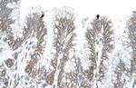 RSRC2 Antibody in Immunohistochemistry (IHC)