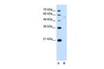 RSRC2 Antibody in Western Blot (WB)