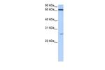 ZNF879 Antibody in Western Blot (WB)