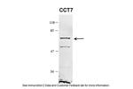 TCP-1 eta Antibody in Western Blot (WB)