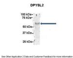 CRMP2 Antibody in Immunoprecipitation (IP)