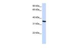 DPPA2 Antibody in Western Blot (WB)