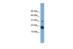 IL1F5 Antibody in Western Blot (WB)