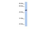 CATIP Antibody in Western Blot (WB)