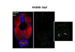 RAB5B Antibody in Immunohistochemistry (IHC)