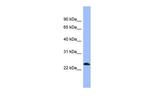 PNOC Antibody in Western Blot (WB)