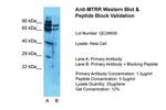 MTRR Antibody in Western Blot (WB)