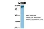 MTRR Antibody in Western Blot (WB)