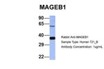 MAGEB1 Antibody in Western Blot (WB)