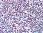 PGLS Antibody in Immunohistochemistry (IHC)