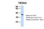 TSTA3 Antibody in Western Blot (WB)