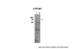 CYP11B1 Antibody in Western Blot (WB)