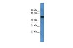 CYP11B1 Antibody in Western Blot (WB)