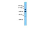 PLEKHG4B Antibody in Western Blot (WB)