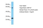 ZNF737 Antibody in Western Blot (WB)