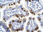 14-3-3 eta Antibody in Immunohistochemistry (IHC)