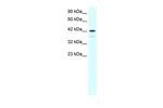 LIM1 Antibody in Western Blot (WB)