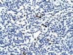 TAL1 Antibody in Immunohistochemistry (IHC)