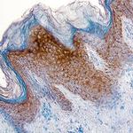 Epiregulin Antibody in Immunohistochemistry (Paraffin) (IHC (P))