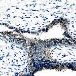 CHI3L1 Antibody in Immunohistochemistry (Paraffin) (IHC (P))