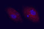 CD83 Antibody in Immunocytochemistry (ICC/IF)