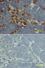 ROBO1 Antibody in Immunohistochemistry (Frozen) (IHC (F))