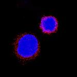 IL31RA Antibody in Immunocytochemistry (ICC/IF)